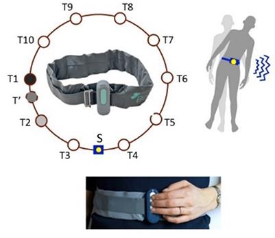 Subconscious vibrotactile stimulation improves mobility and balance in patients with bilateral vestibulopathy: adherence over 2 years